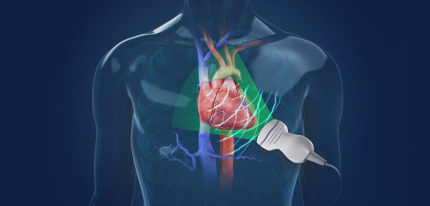 Echocardiogram MedAlliance Cardiology Albury Wodonga Heart Specialist